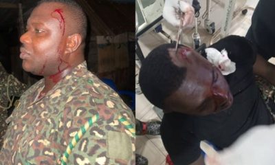 Afloa GIS officers, Newscenta, Night patrol, attacked, injured, Afloa GIS officers attacked, injured during night patrol, Ghana News,