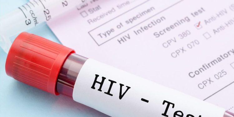 HIV test kits